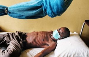 8,629 Tuberculosis cases treated out of 14,908 cases identified in Niger Tuberculosis.jpg